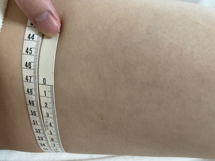 slimburlesque-thighs-before