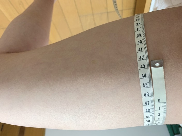 sulaline-thighs-before