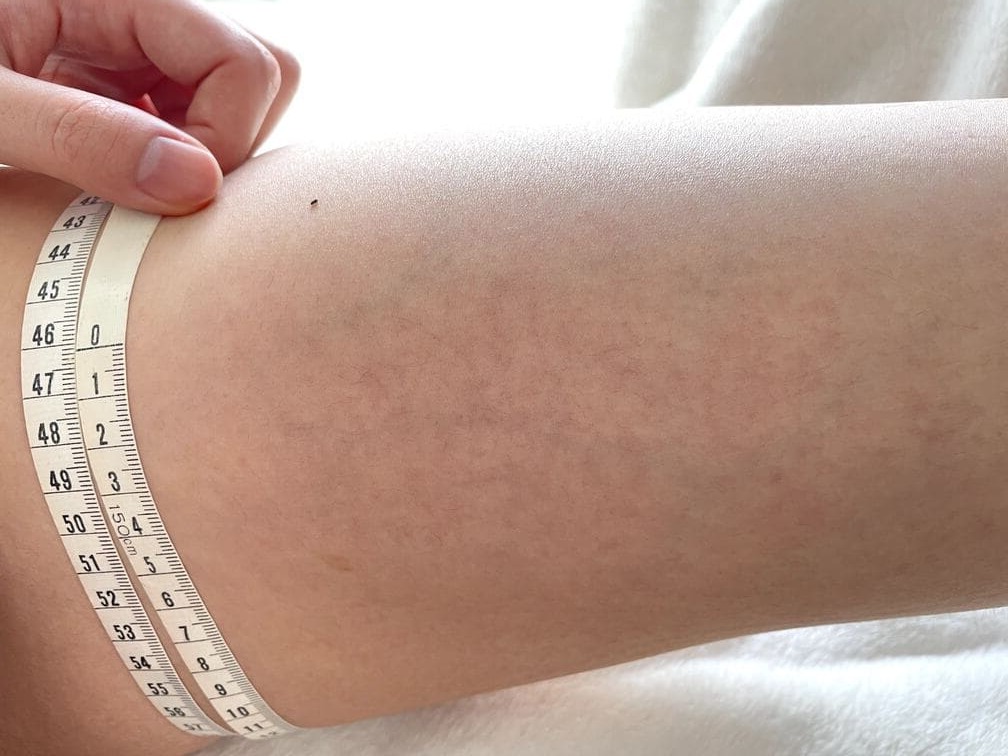 gyugyuleggings-thighs-after